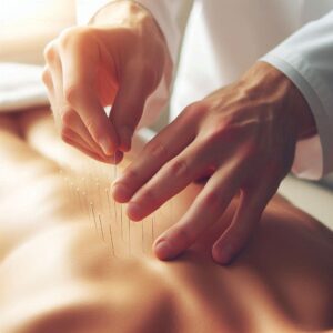 CPT Code for Dry Needling