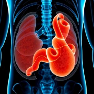 ICD-10 Codes for Diverticulitis