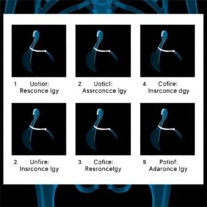 ICD-10 codes for Urinary Tract Infections