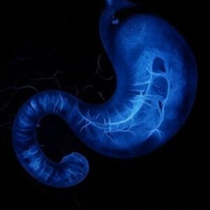 ICD-10-PCS Code for Endoscopic Retrograde Cholangiopancreatography