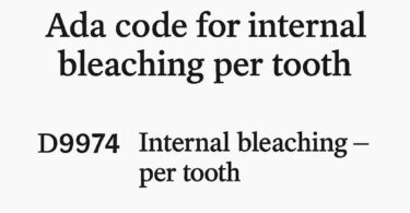 ADA Code for Internal Bleaching Per Tooth