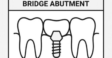 Dental Code Implant Supported Bridge Abutment