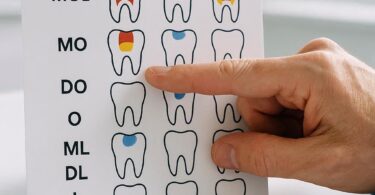 Dental Code for Filling Teeth