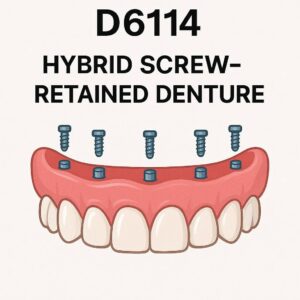 Dental Code for Hybrid Screw-Retained Denture