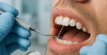 Dental Code for Probing