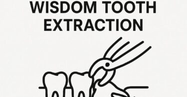 Dental Code for Wisdom Tooth Extraction