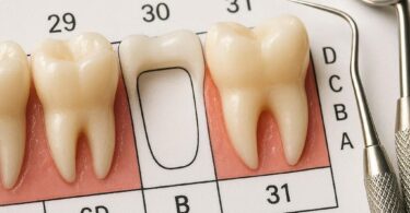 Dental Code for a Missing Tooth