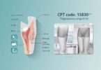 CPT Code Q0091: The Complete Guide to Screening Pap Smear Collection ...