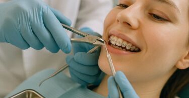 Dental Code for Wire Removal