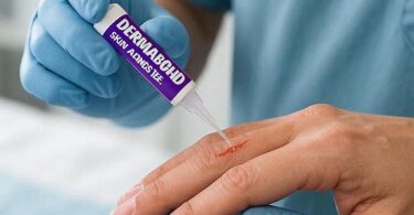 CPT Code for Dermabond