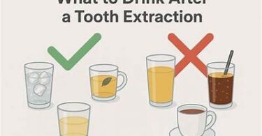 When Can I Drink Iced Coffee After Wisdom Tooth Extraction?