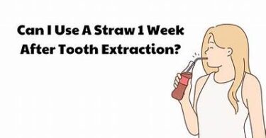 When Is It Okay To Use A Straw Following Molar Extraction?