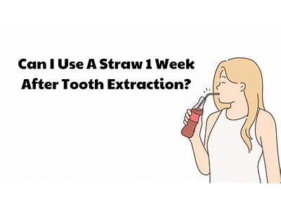 When Is It Okay To Use A Straw Following Molar Extraction?
