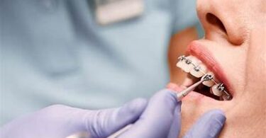 When Is Orthodontic Treatment Required?